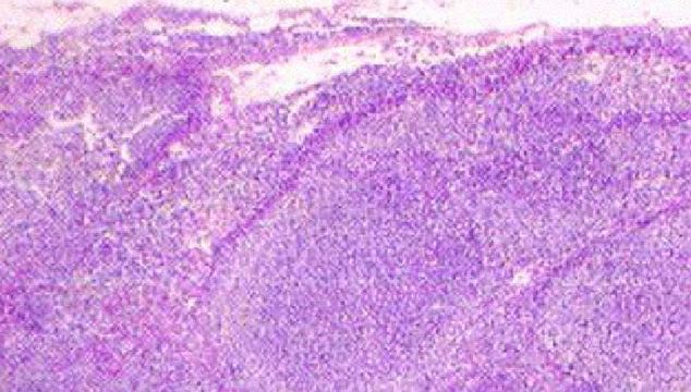 Microscopy image of cell evidence under review
