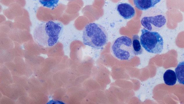 Microscopy image of cell evidence under review
