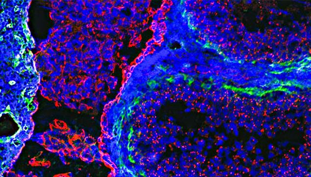 Microscopy image related to the video topic