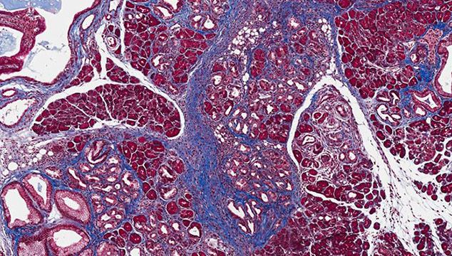 Microscopy image related to the video topic